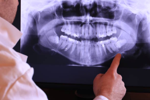 Best Emergency Dental Care for Abscessed Tooth in Oskaloosa, IA