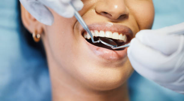 Best Pediatric Emergency Dentist in Oskaloosa, IA