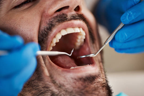  Oskaloosa, IA Emergency Dentist Pros