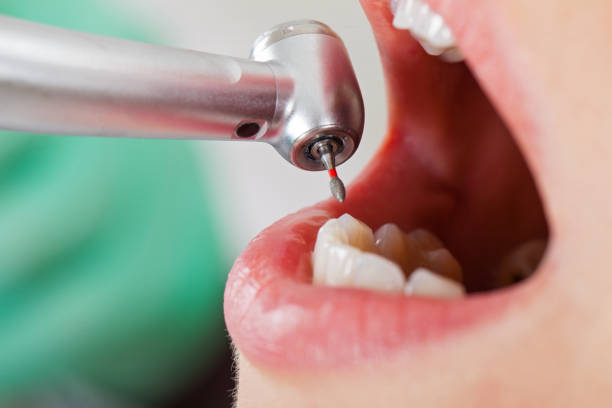 Best Weekend Emergency Dentist in Oskaloosa, IA